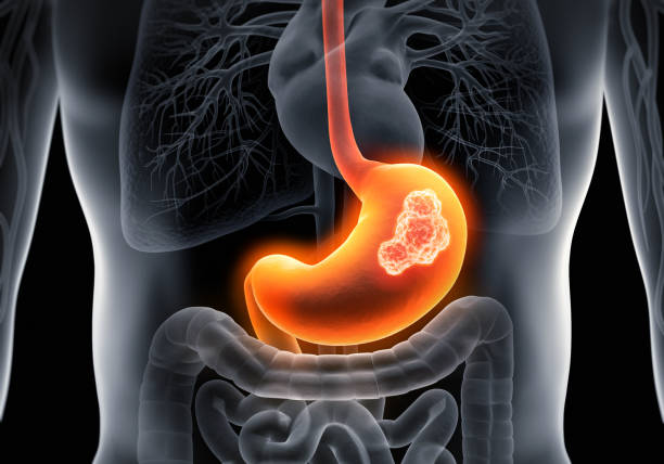 Your Stomach Gets a New Lining Every Few Days