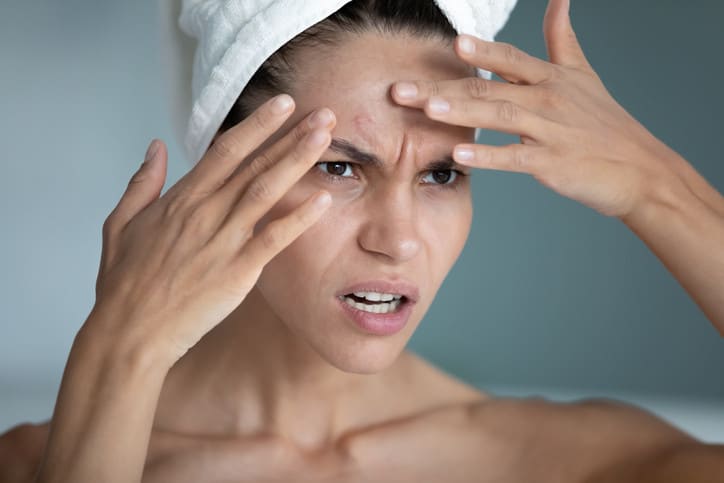 Stress Impacts Skin