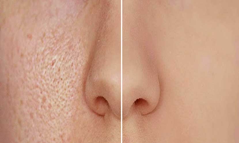 Pores Don’t Open And Close
