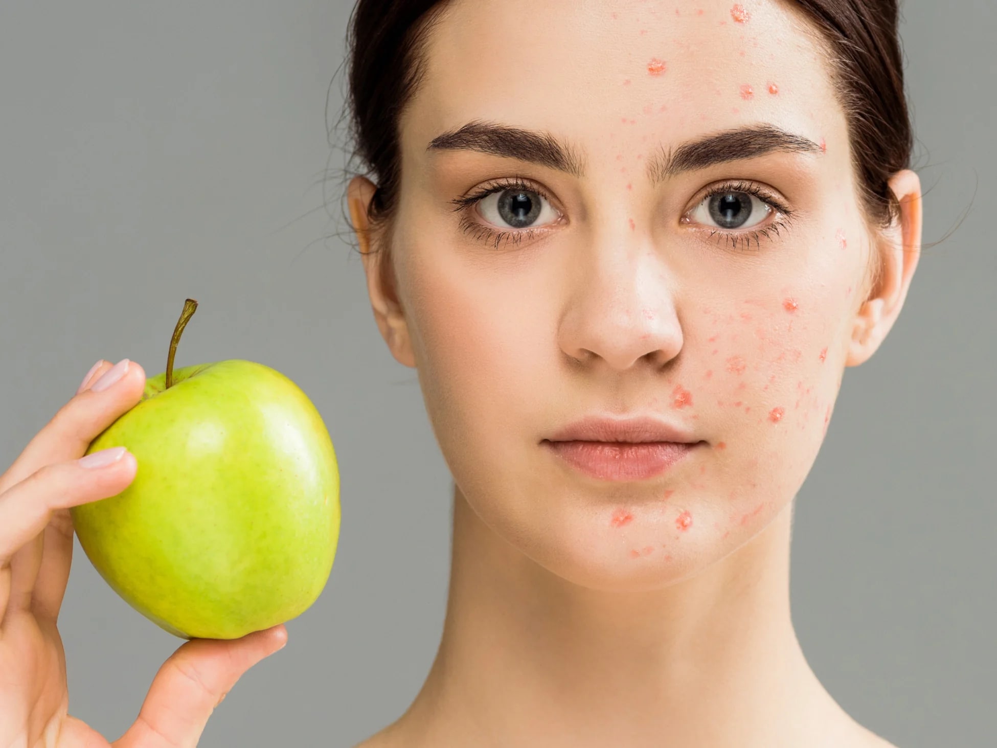 Diet Shows On Your Face