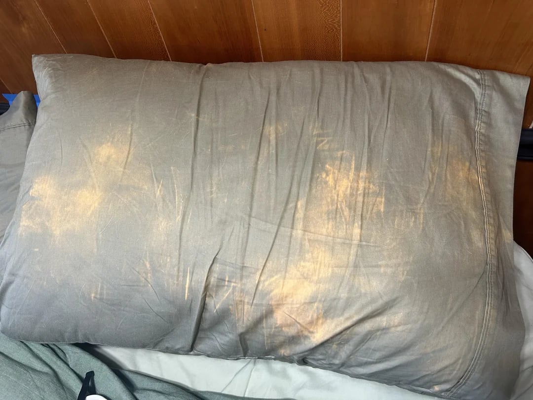 Dirty Pillowcases = Skin Enemies