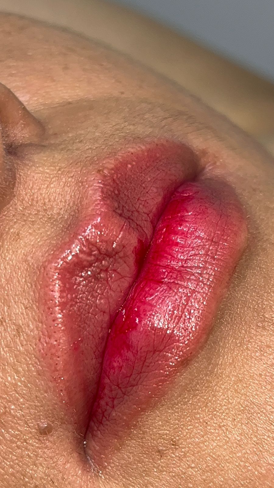 Hidragloss
