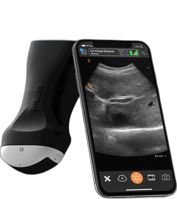 C3 Virtual Scanner Portable Ultrasound Probe