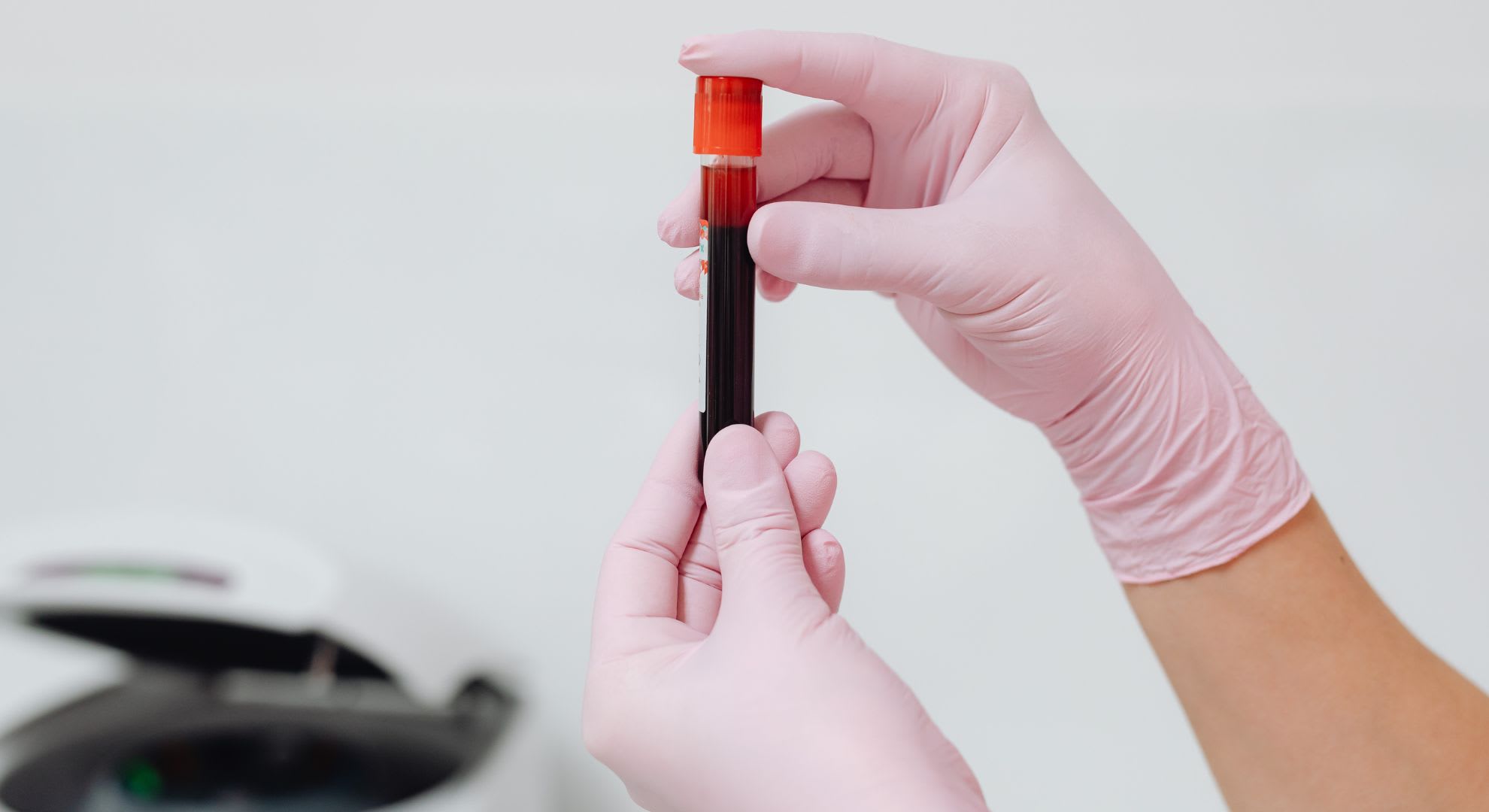 ApoB Test: 2026 Apolipoprotein B Guide For Clarity