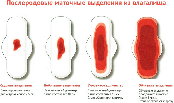 Норма виділень після пологів