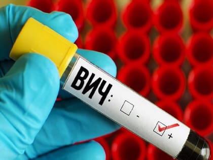 Ситуация с ВИЧ в Иркутской области: актуальные данные и меры профилактики