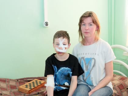 Врачи ОГАУЗ ГИМДКБ продолжают лечение ребенка, получившего множественные укушенные раны лица