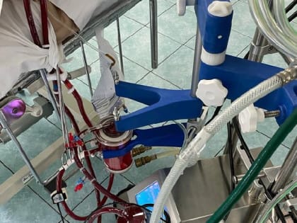 Врачи Иркутской областной больницы спасли мужчину с нарушением работы сердца