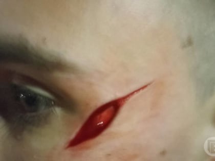 В Волгограде возле школы №15 мужчина порезал ножом лицо 17-летнему парню