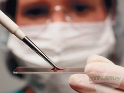 Жителям Волгоградской области рассказали о тестировании на ВИЧ