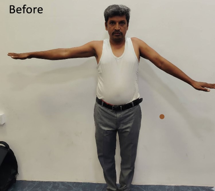 Patient Testimonial 8