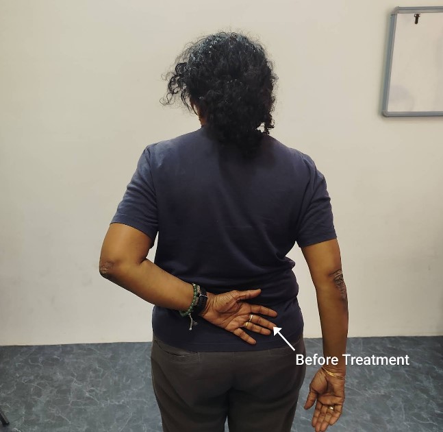 Patient Testimonial 10