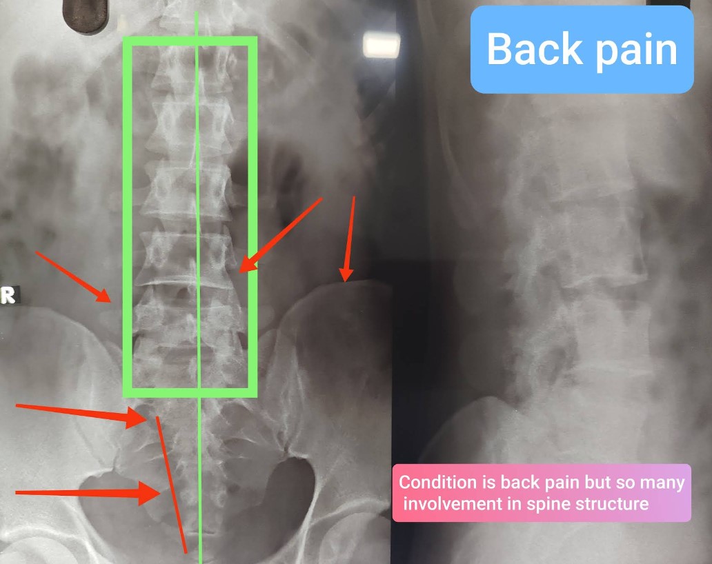 Patient Testimonial 11