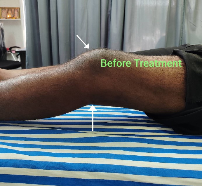 Patient Testimonial 12