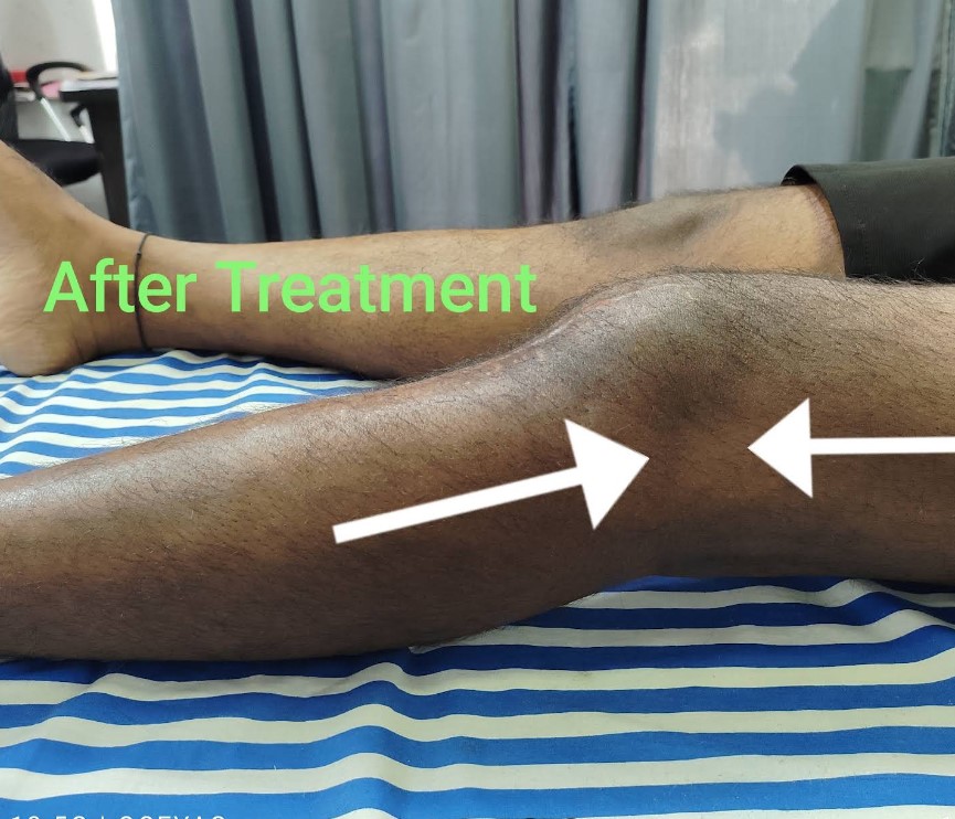 Patient Testimonial 13