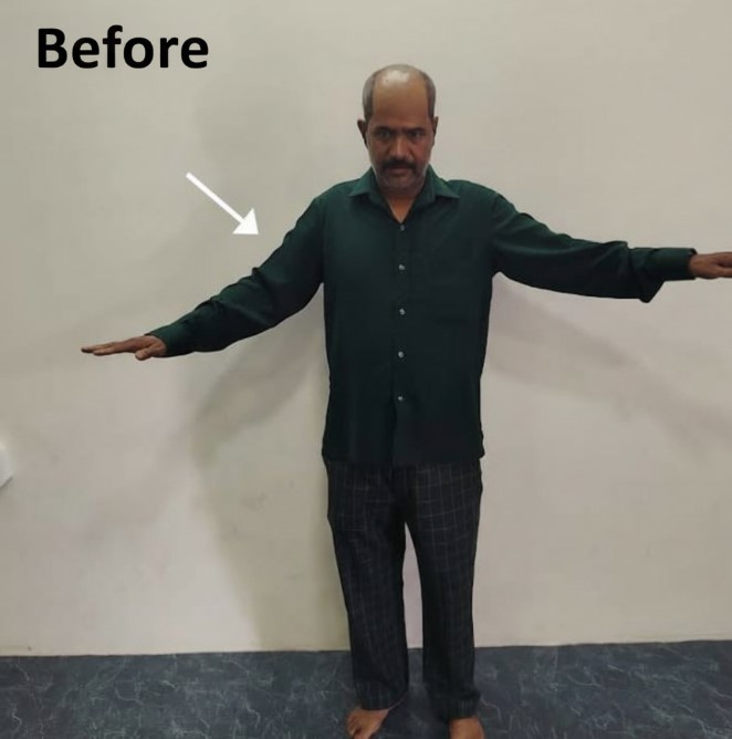 Patient Testimonial 1