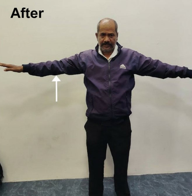 Patient Testimonial 2