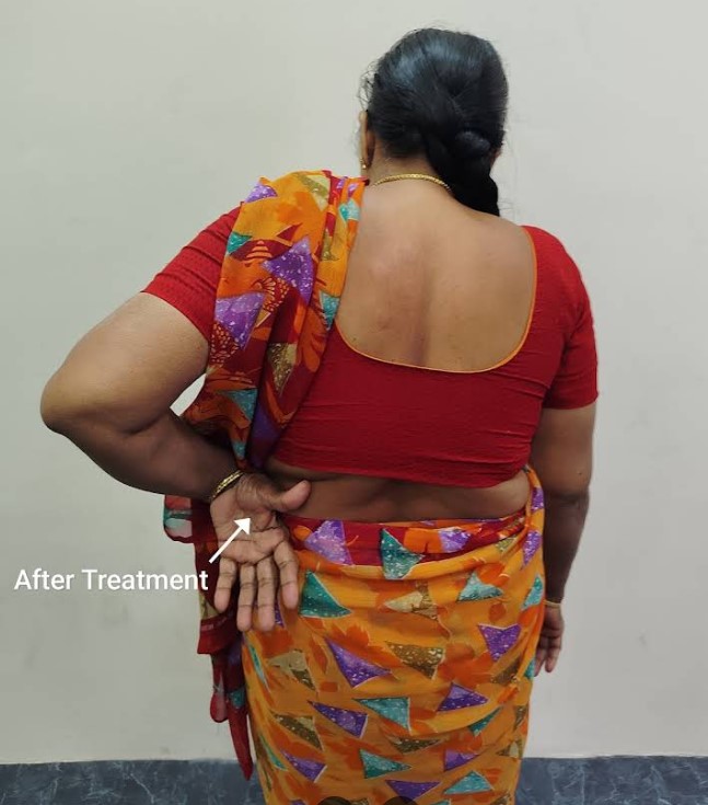 Patient Testimonial 7