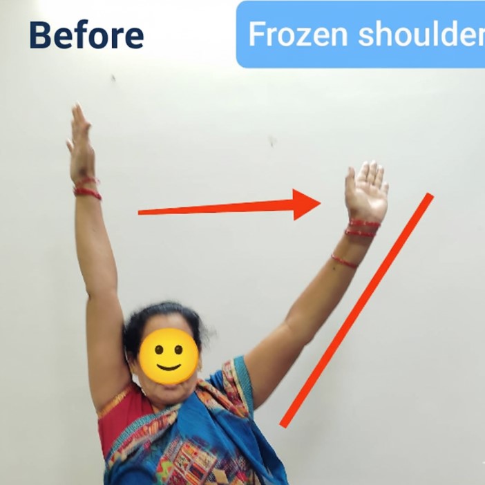 Patient Testimonial 3