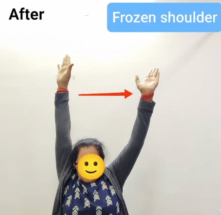 Patient Testimonial 4