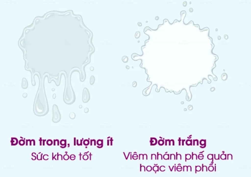 non-ra-djom-trang:-nguyen-nhan-trieu-chung-va-cach-djieu-tri-duoc-binh-djong