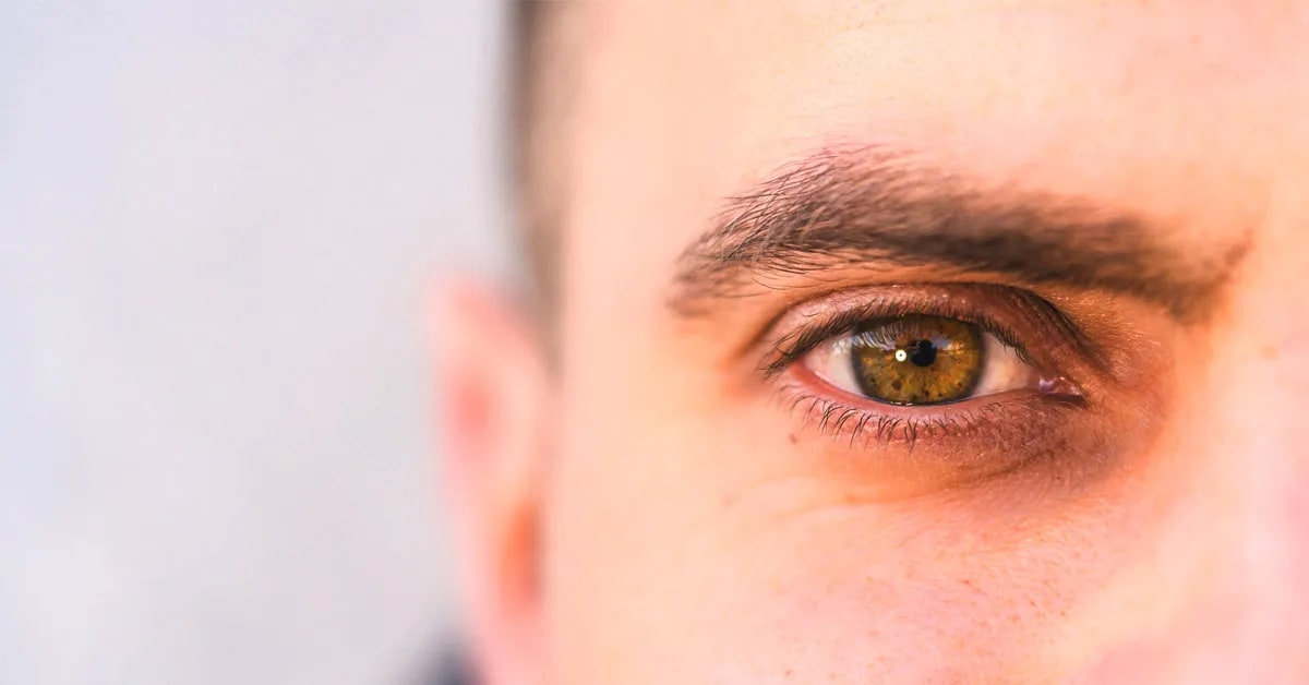 What you must know about Intriguing Eye freckles?