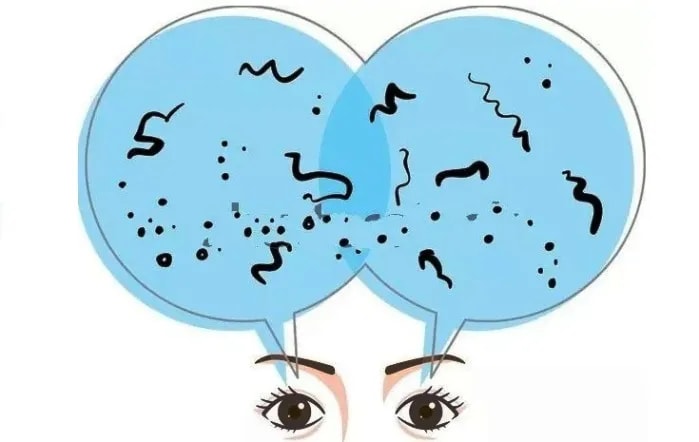 What are eye floaters? How to reduce floaters in eyes naturally?