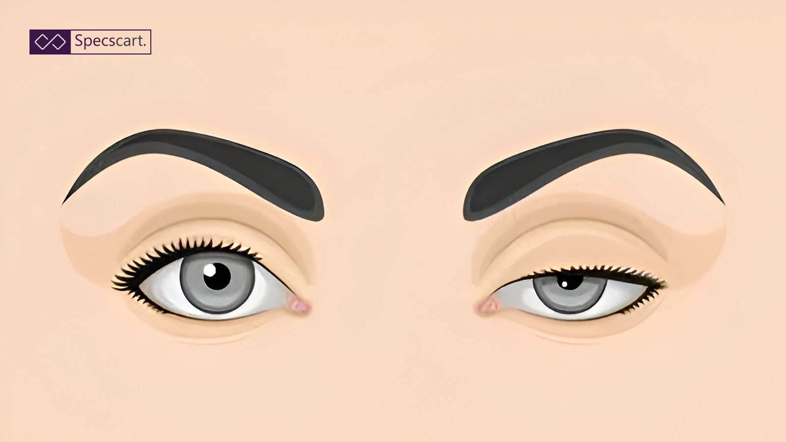 Ptosis: Everything You Need to Know About Eyelid Drooping