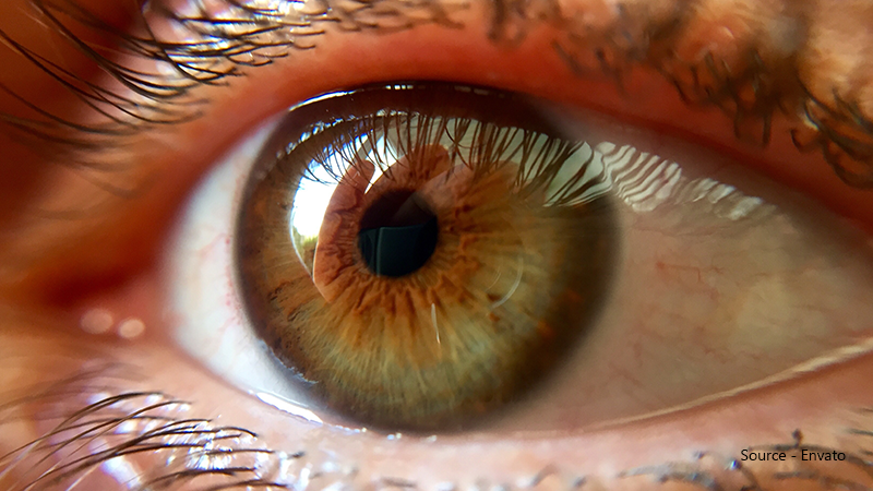 What Causes Hazel Eye Colour?
