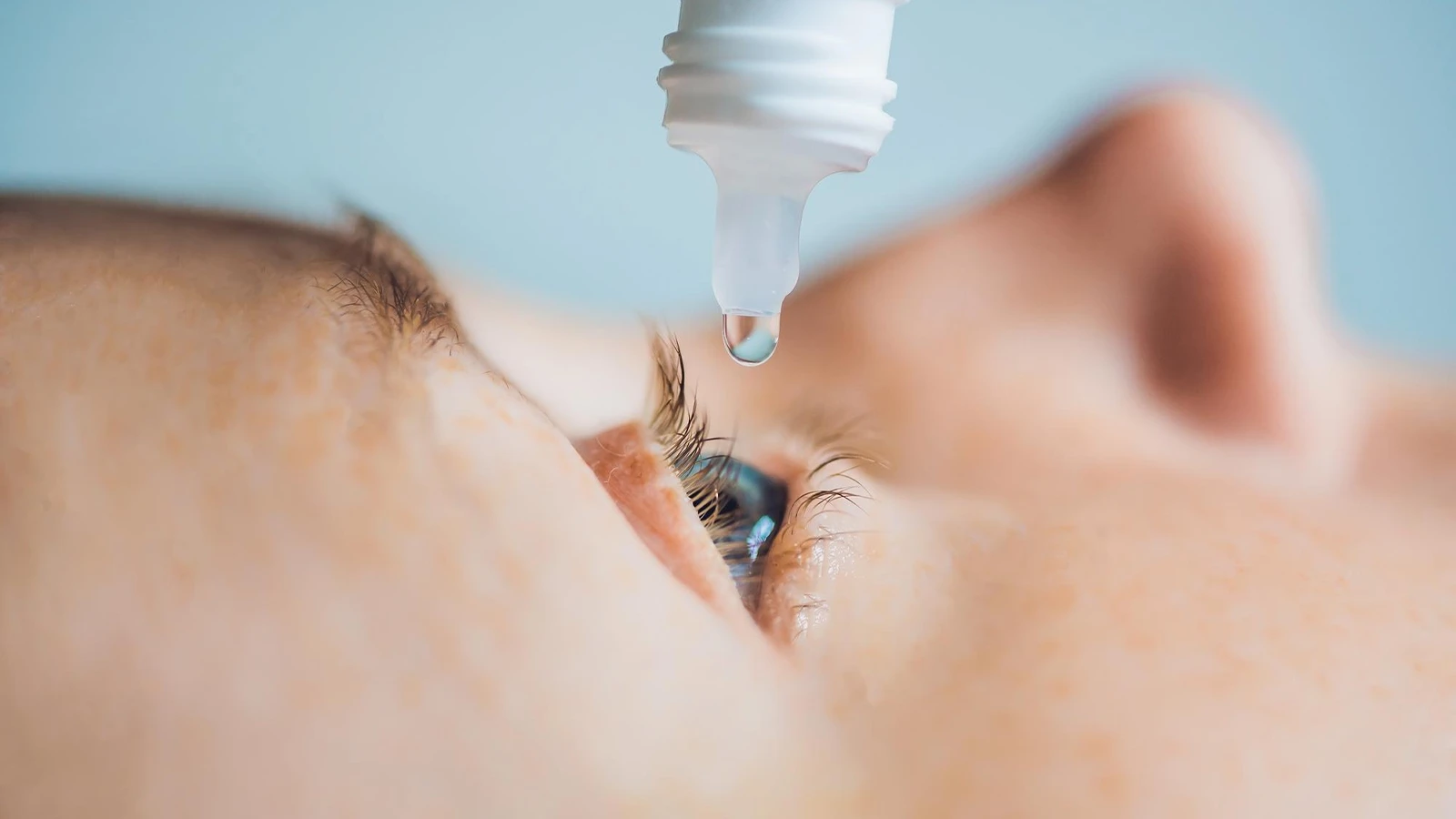 What’s the Treatment of Stye
