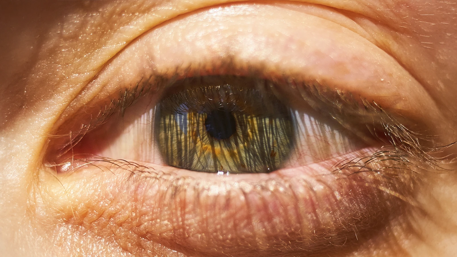 What Causes Photophobia