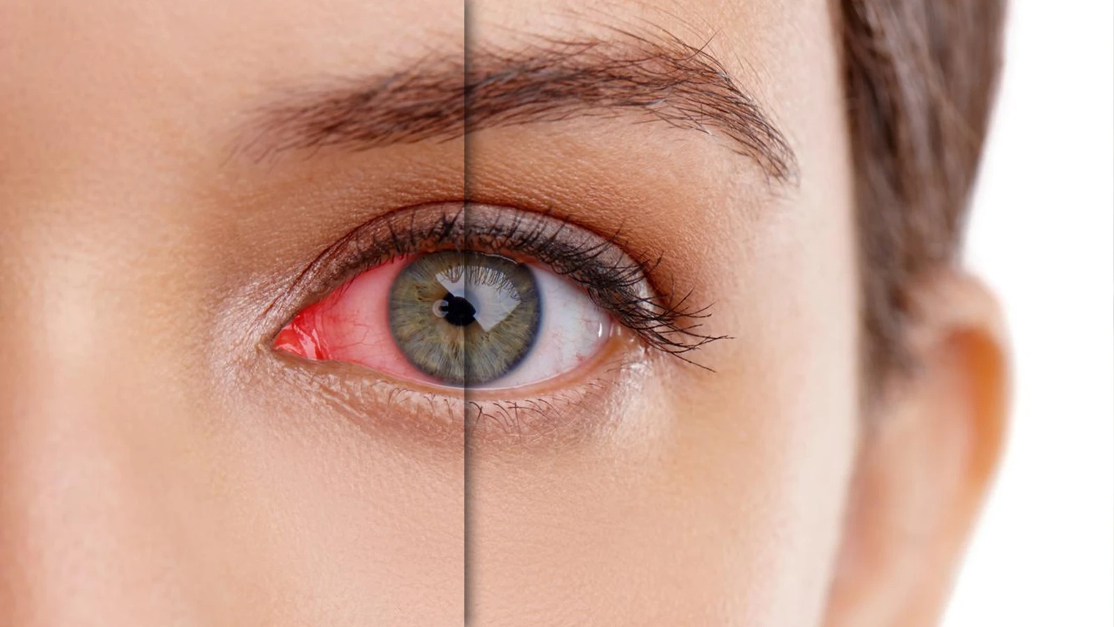 How to Know About a Foreign Object in the Eye