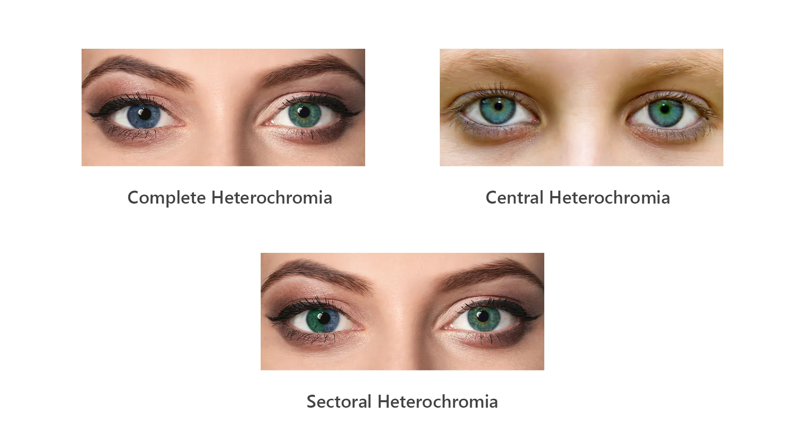 Heterochromia What Causes Differently Coloured Eyes Specscart Heterochromia What Causes Differently Coloured Eyes Specscart