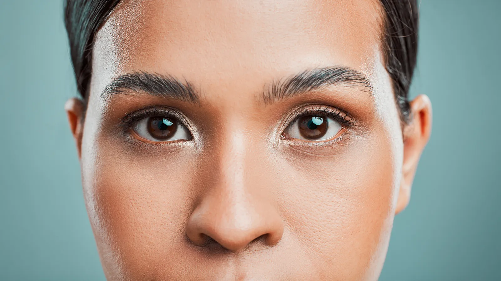 What Else Causes Dark Circles