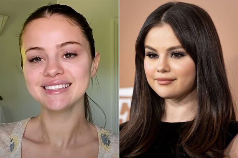 Selena Gómez: Transparencia y cuidado natural de la piel