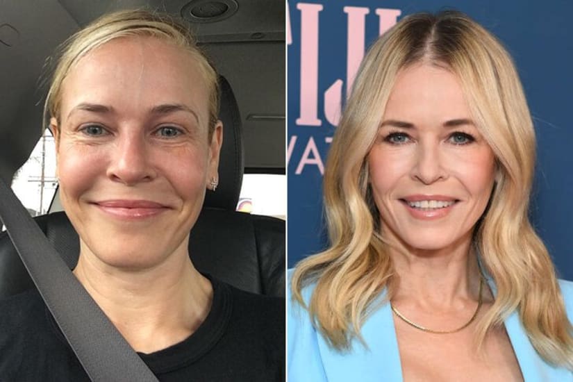 Los secretos de belleza de Chelsea Handler: más allá de la risa