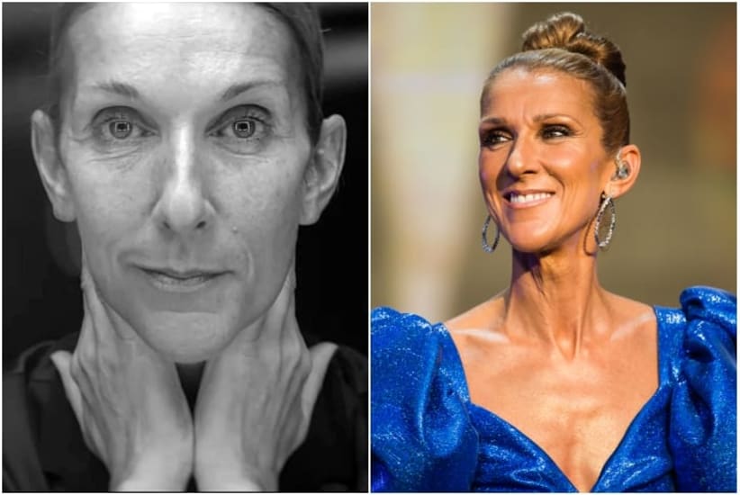 La cantante canadiense que conquistó el mundo con sus icónicas canciones
