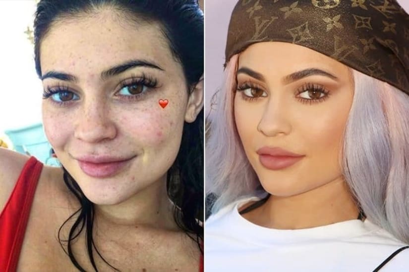 Los secretos de belleza de Kylie Jenner que la mantienen radiante