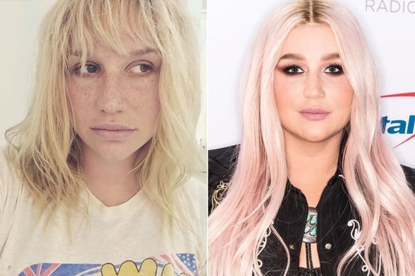 Kesha: La estrella pop que conquistó el mundo