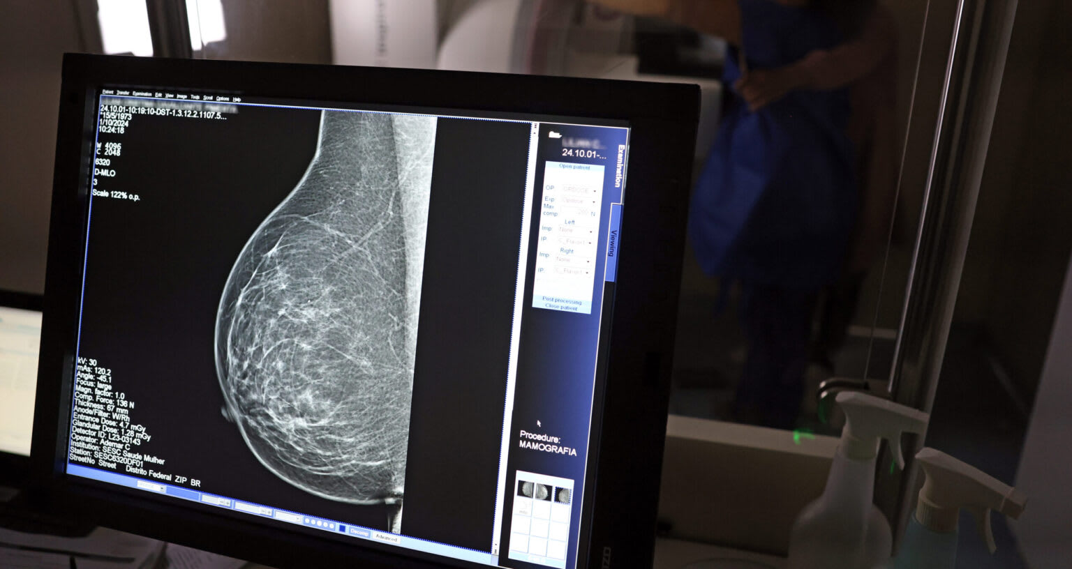 Outubro Rosa: Piauí realiza 57 mil mamografias