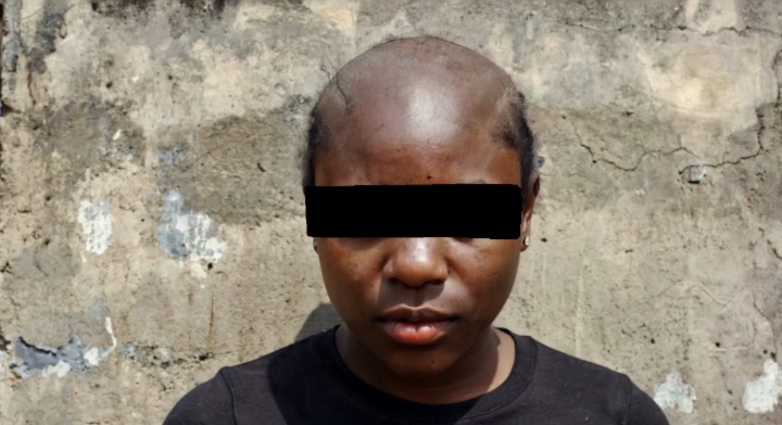 AMARACHI before using Beyond Beauty