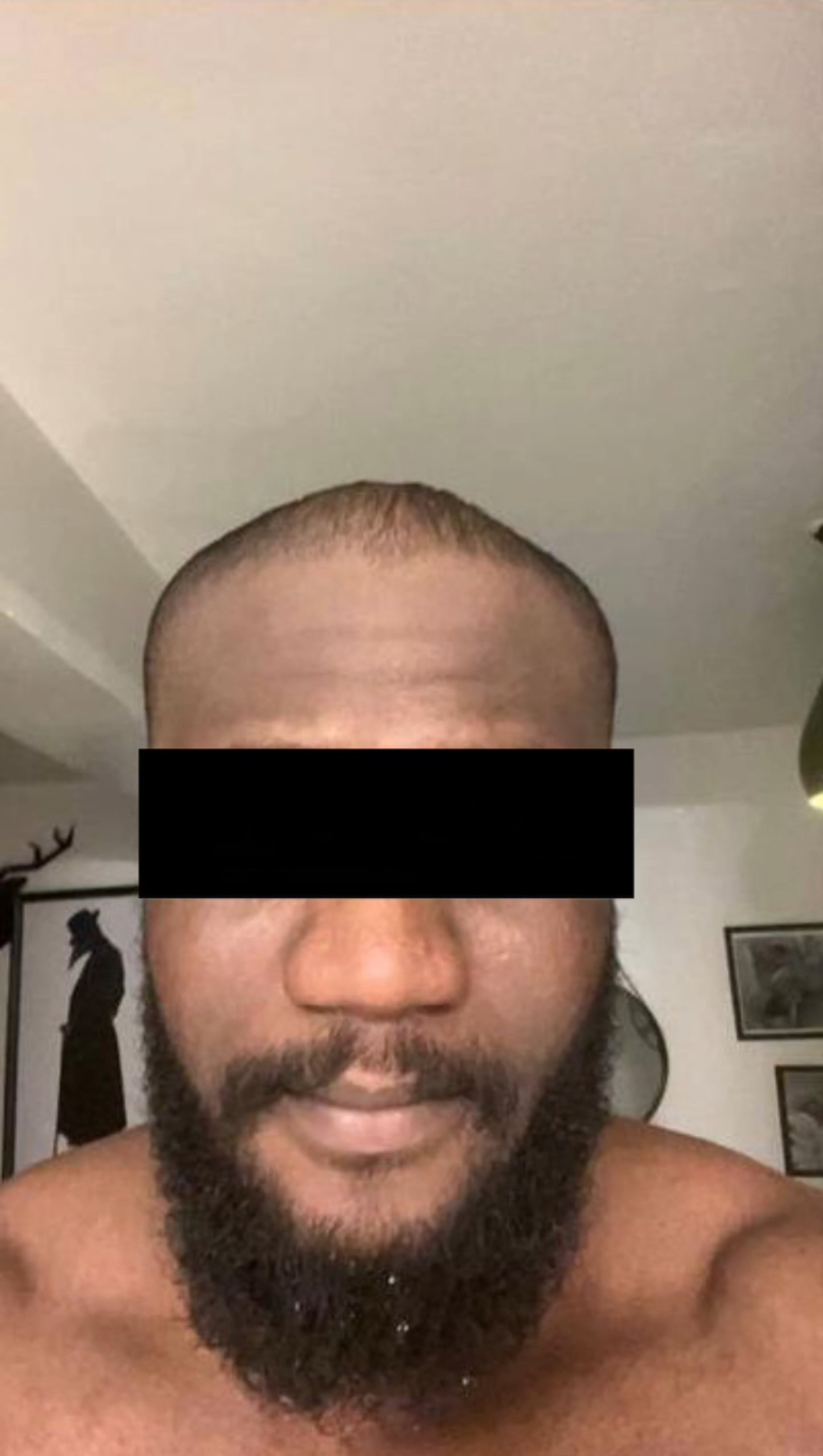 TOBI after using Beyond Beauty