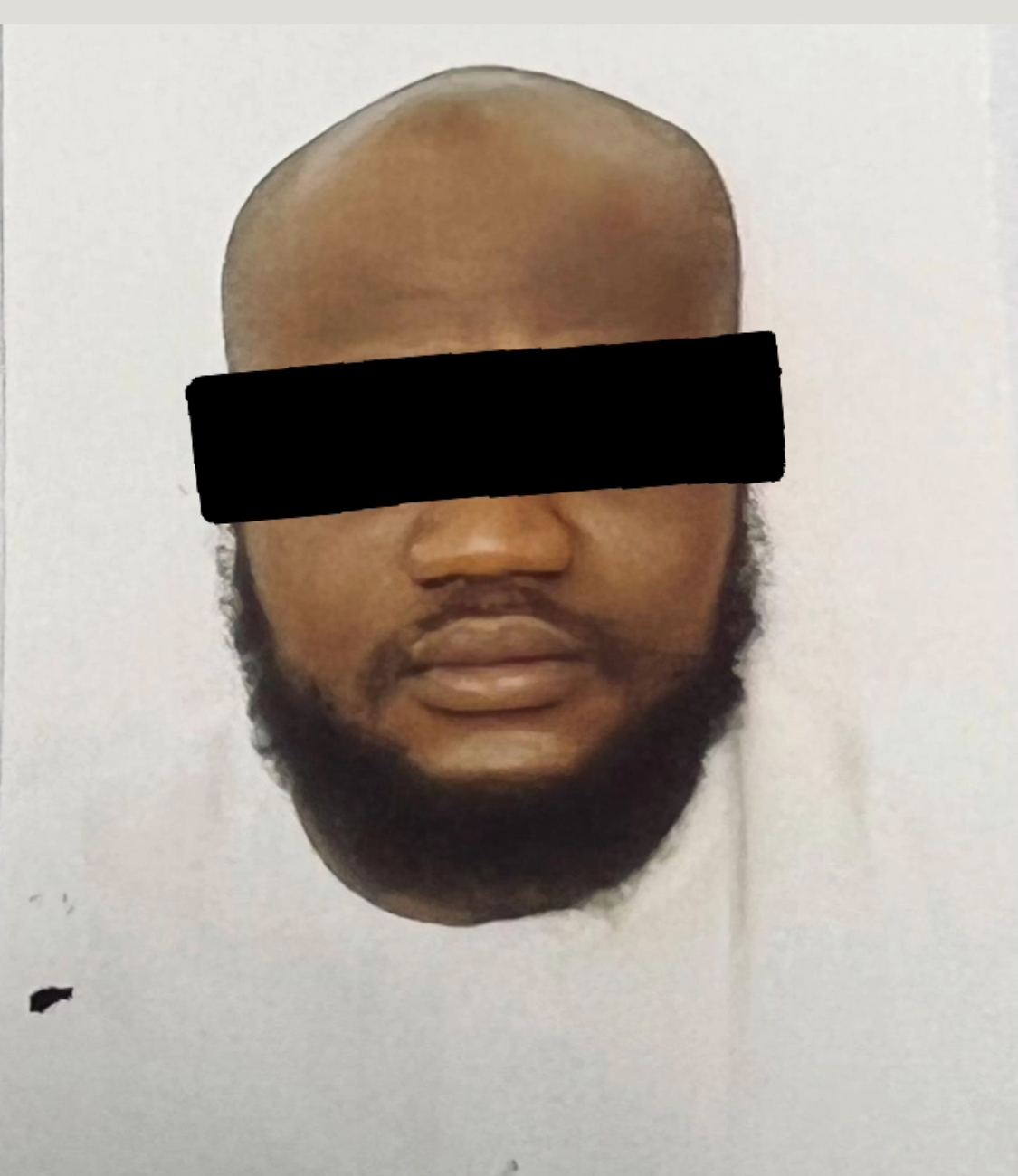 TOBI before using Beyond Beauty