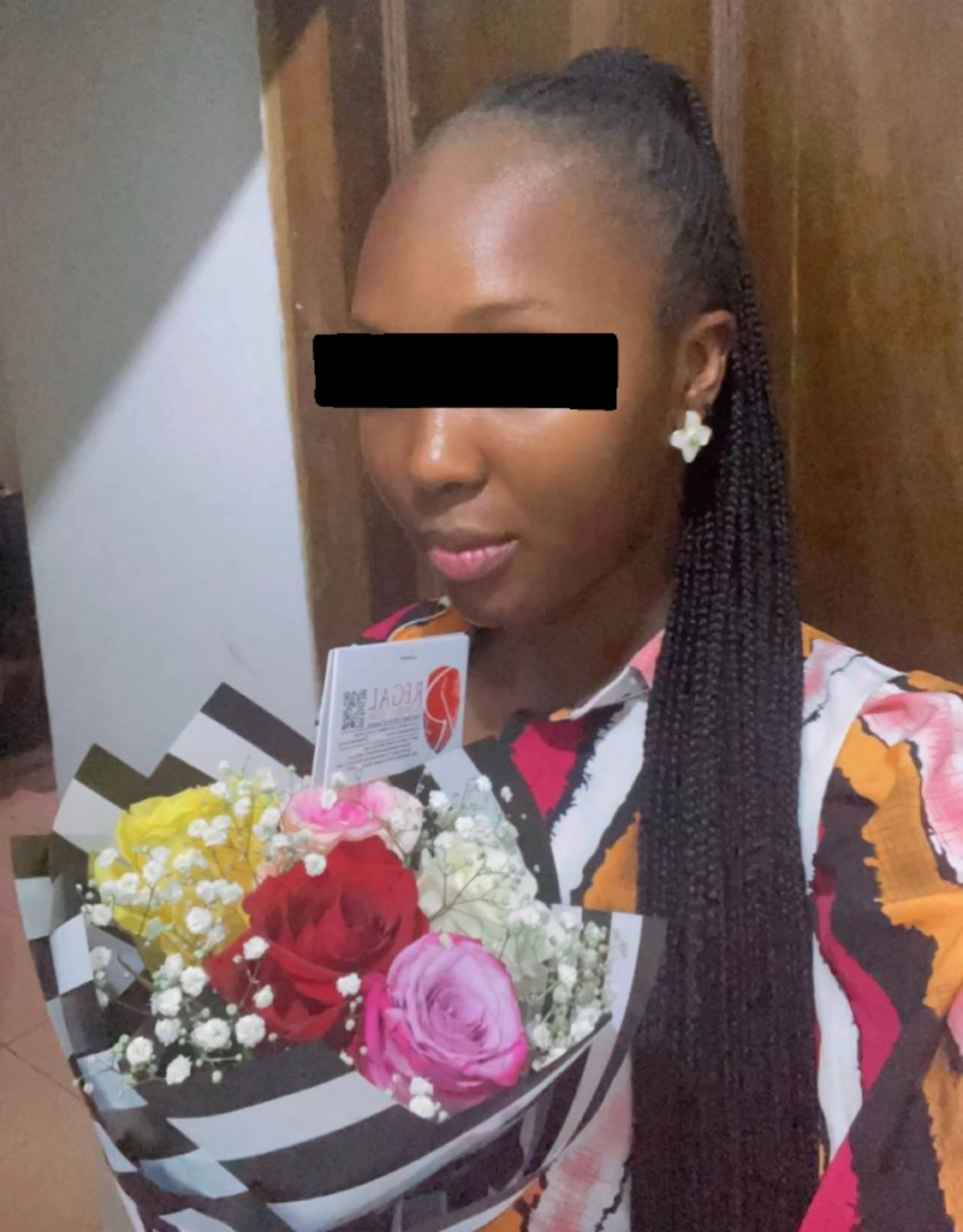 STELLA before using Beyond Beauty