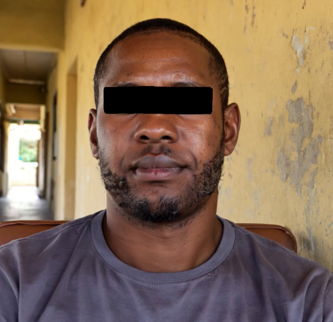 EMEKA before using Beyond Beauty
