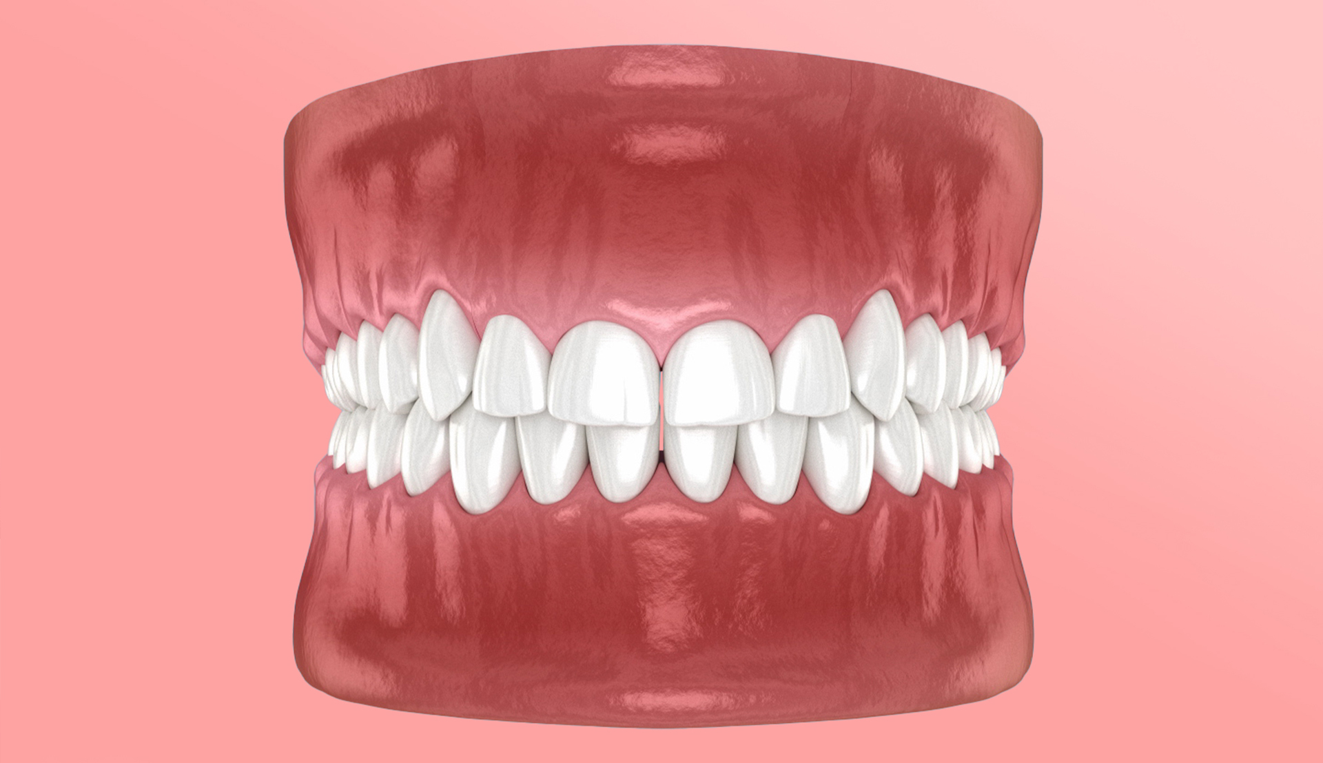 Dentures