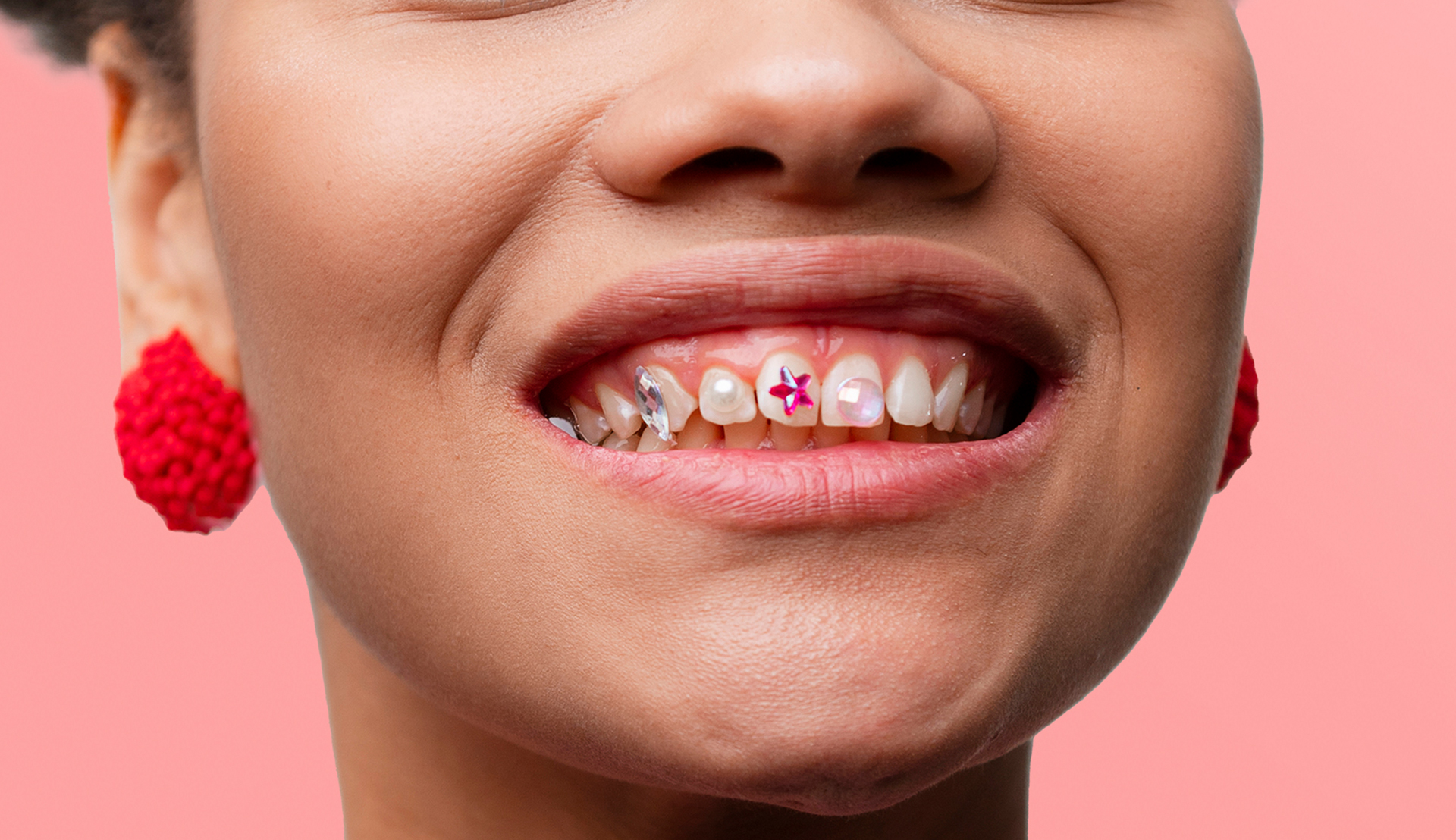 Tooth Gem Placement