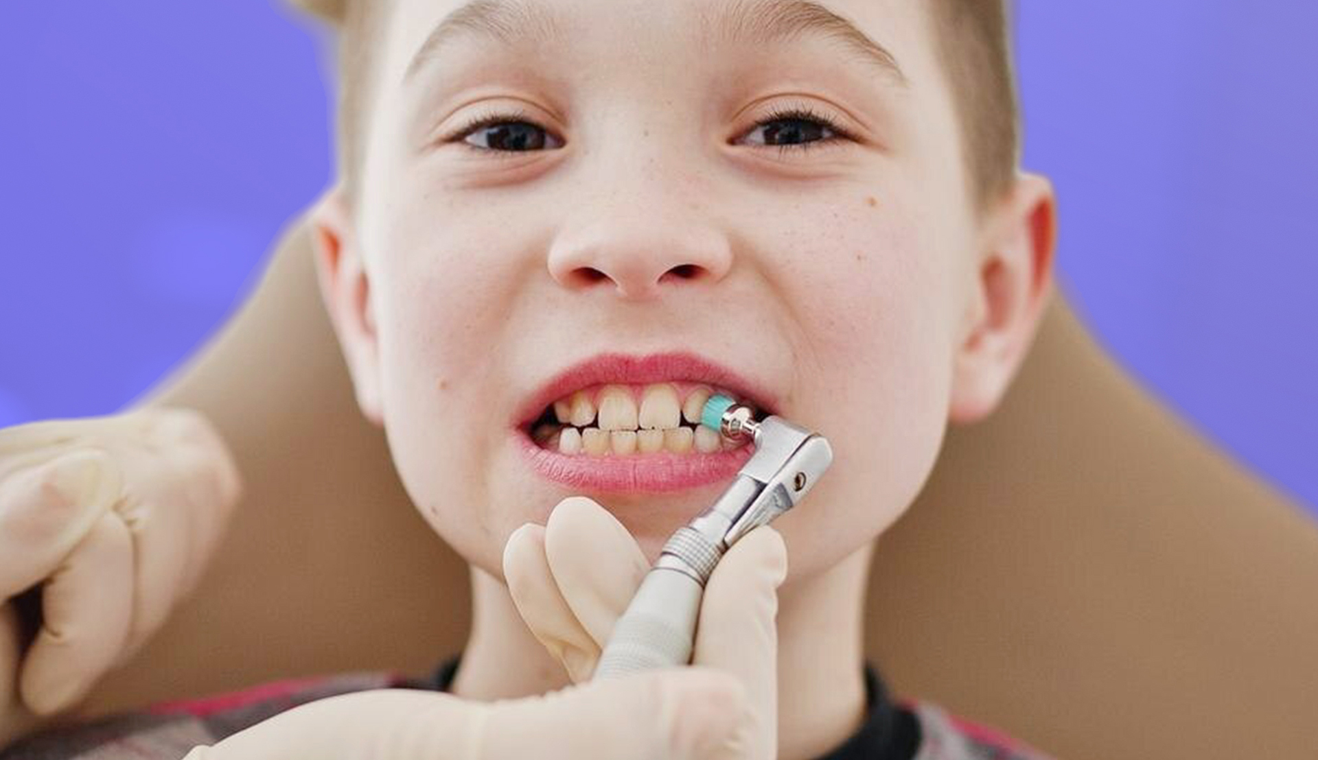 Kids’ Scaling and Polishing