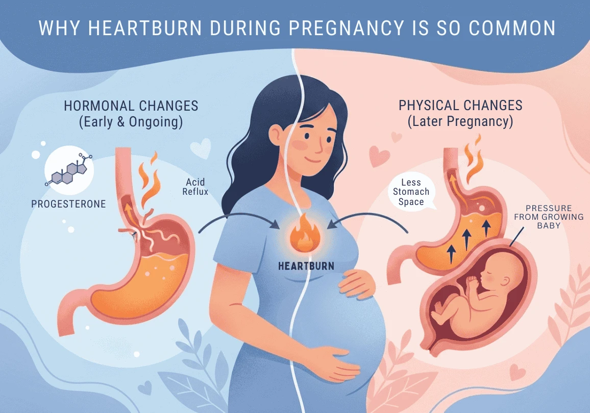 Reasons of Heartburn during Pregnancy