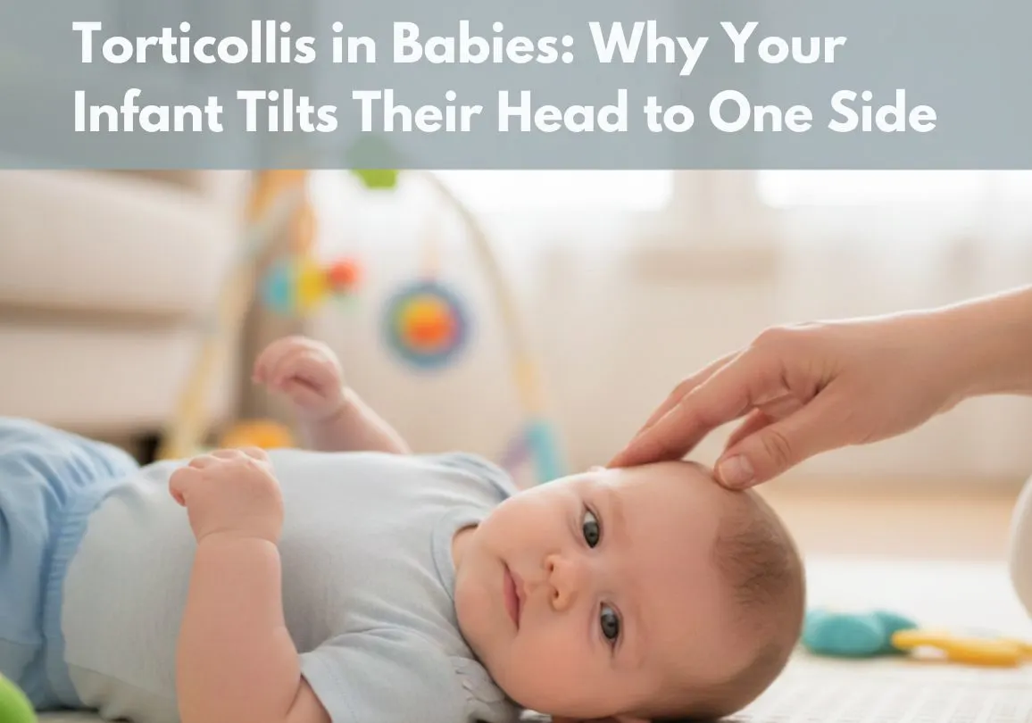 Torticollis in Infants